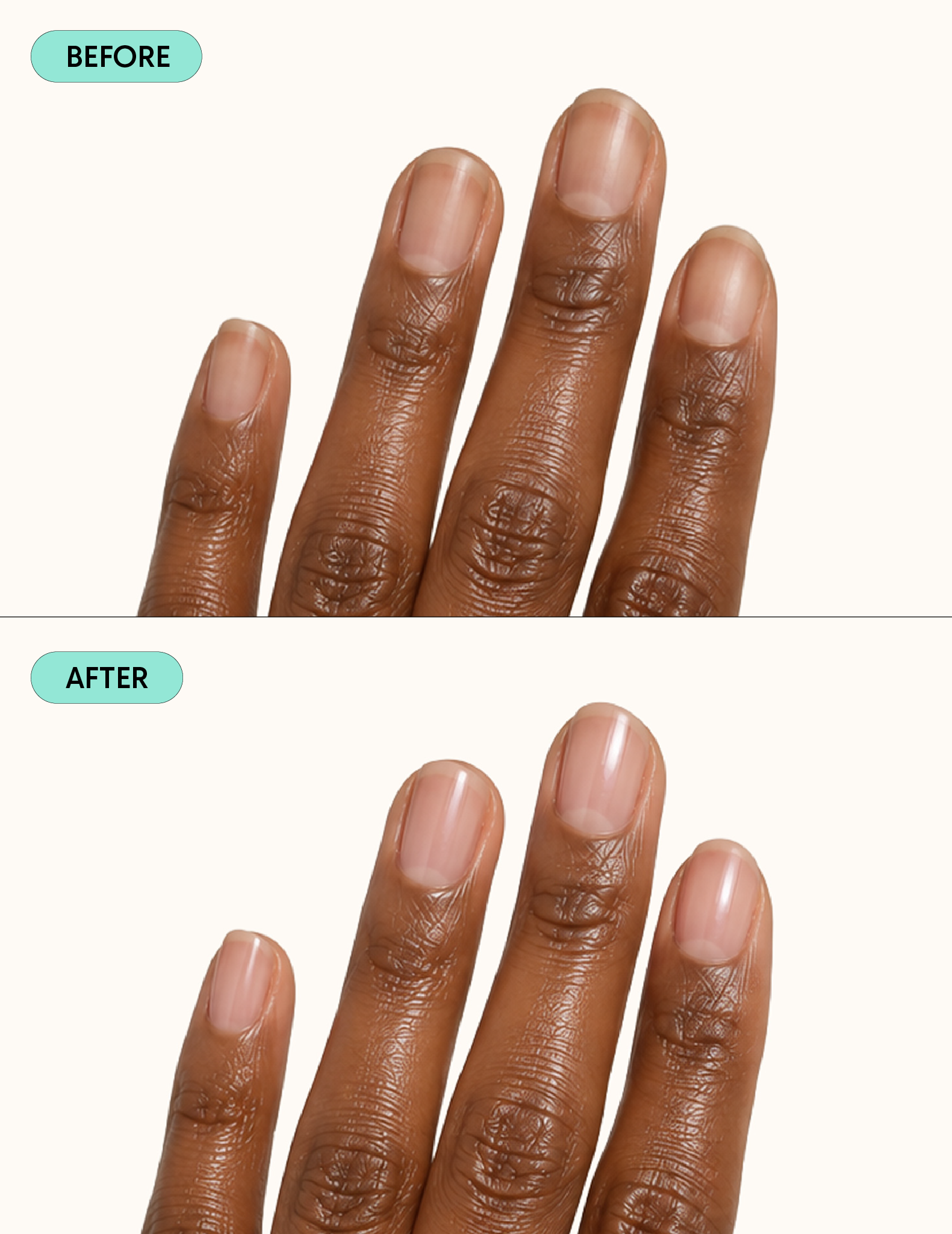 Nail Ridge Filler